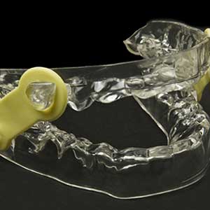 Sleep apnea oral appliance