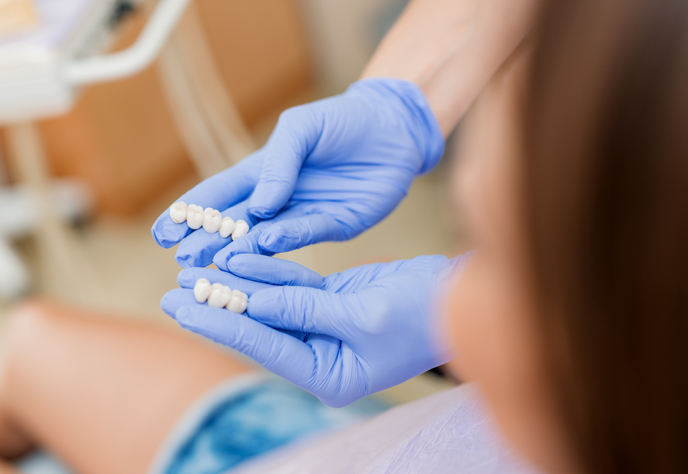 dentist showing patients dental bridges