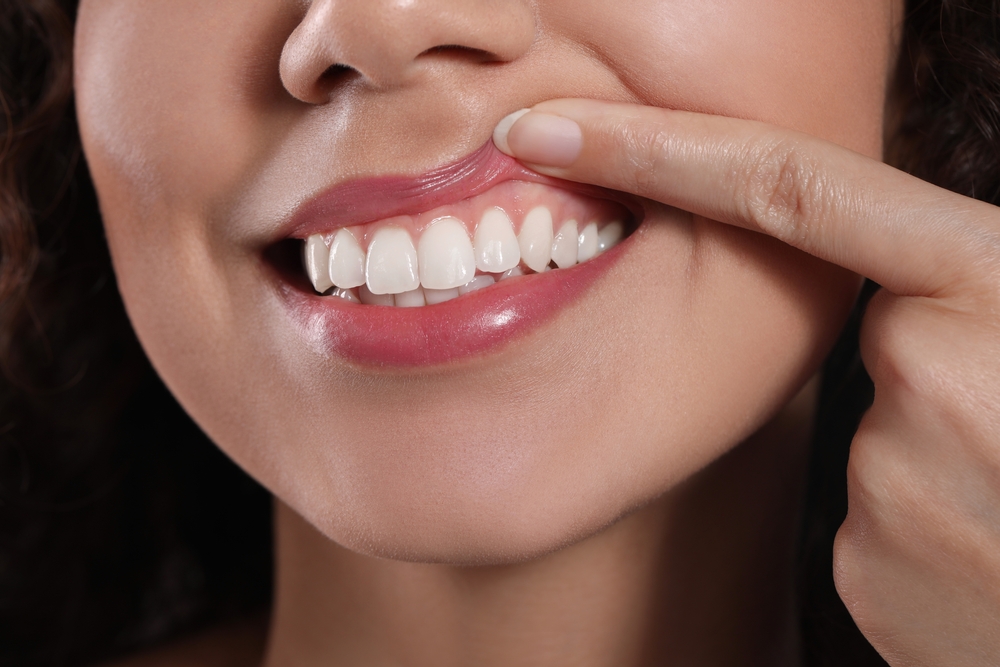 woman lifting lip to show gums